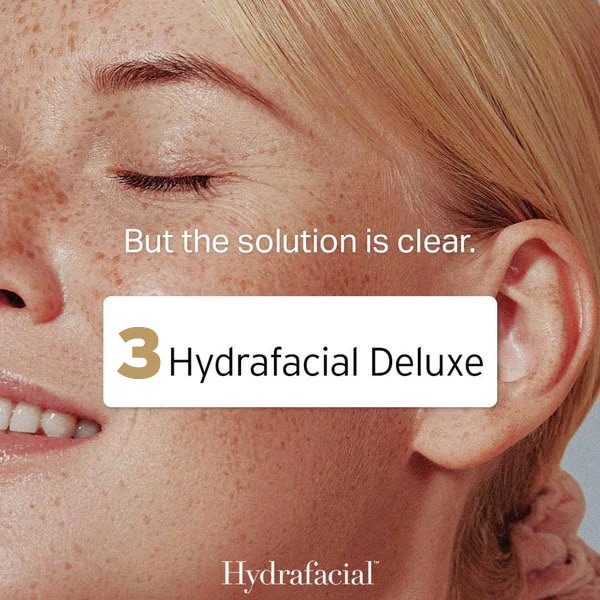 Hydrafacial® Deluxe - Image 7