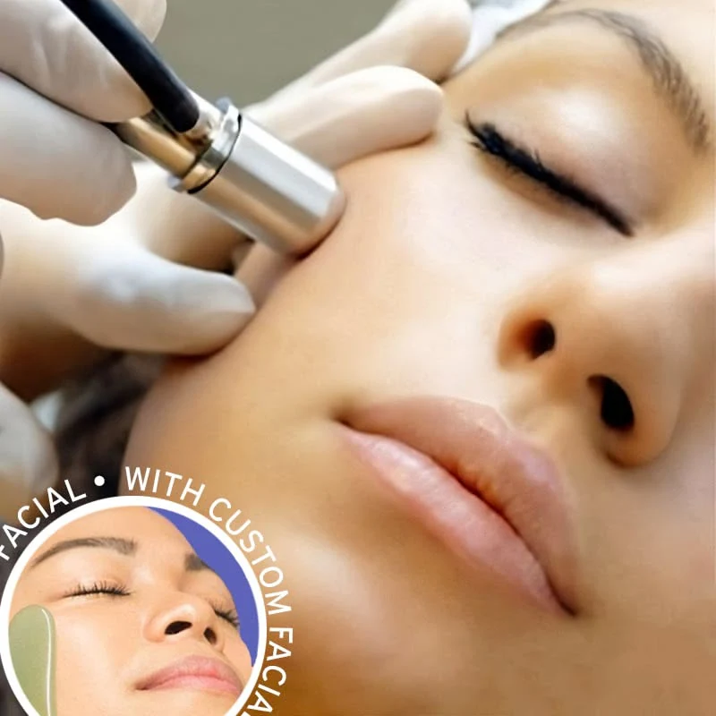 Microdermabrasion - Image 9